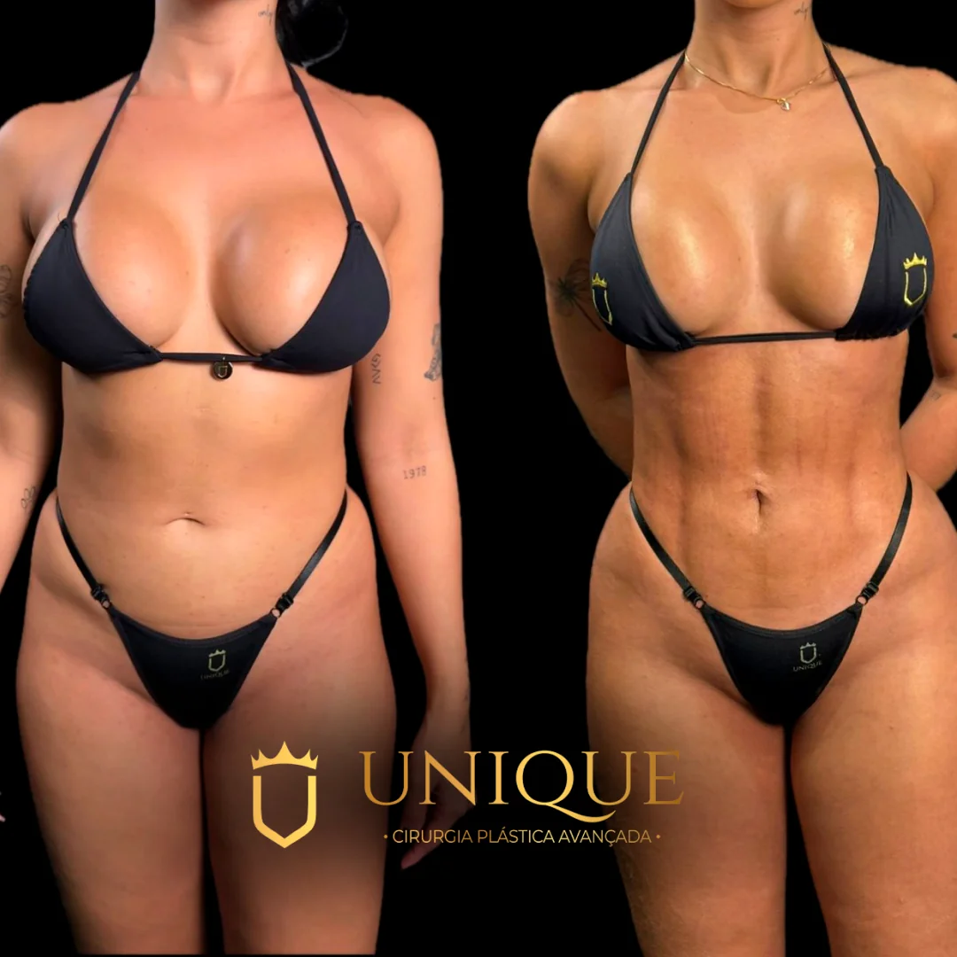 Antes e depois — resultado real